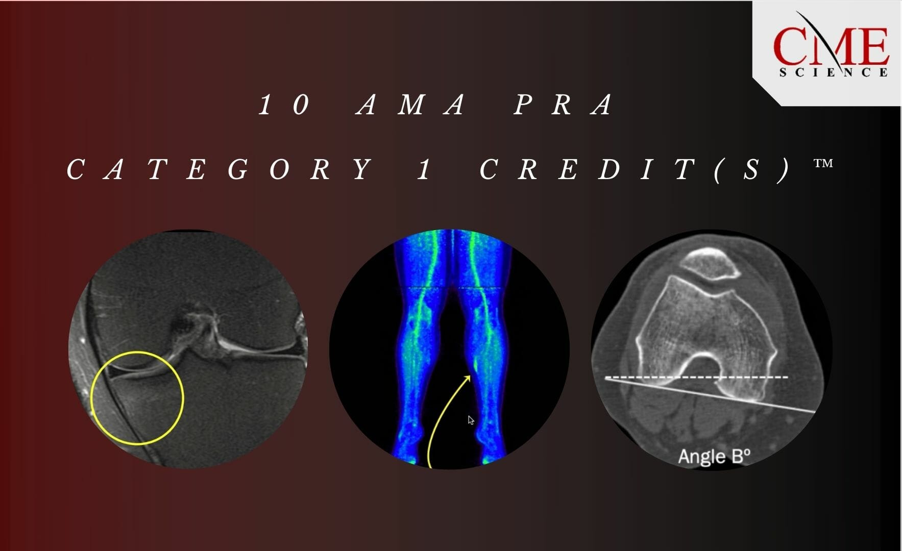 Radiology CME Online Courses & Webinars Available 24/7